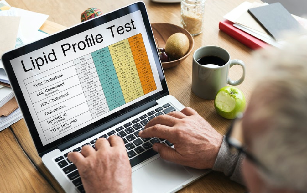 lipid profile test on desktop